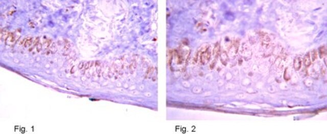 Anti-Harmartin (TSC1) Antibody ascites fluid, from mouse