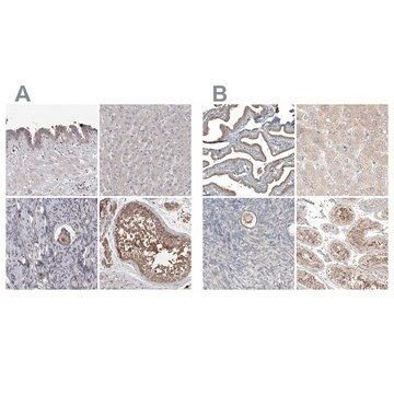 Anti-PCM1-Antikörper in Kaninchen hergestellte Antikörper Prestige Antibodies&#174; Powered by Atlas Antibodies, affinity isolated antibody, buffered aqueous glycerol solution, Ab2