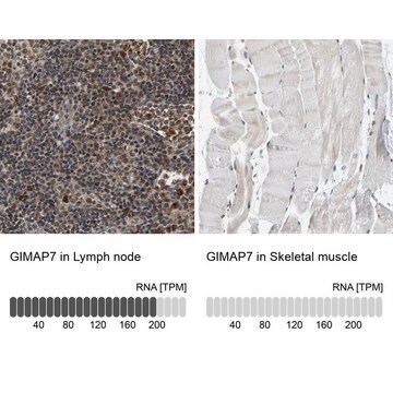 Anti-GIMAP7 antibody produced in rabbit Prestige Antibodies&#174; Powered by Atlas Antibodies, affinity isolated antibody, buffered aqueous glycerol solution, Ab2