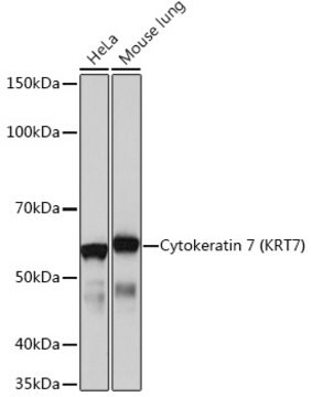 Anti-Cytokeratin 7 (KRT7) Antibody, clone 5V4M10, Rabbit Monoclonal