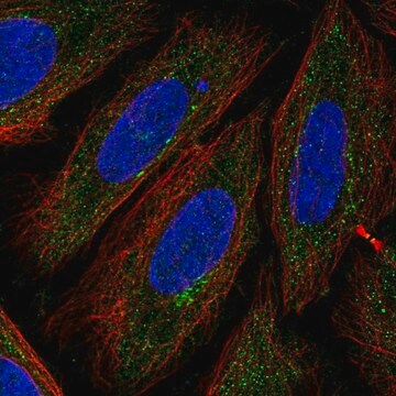 Anti-TTPAL antibody produced in rabbit Prestige Antibodies&#174; Powered by Atlas Antibodies, affinity isolated antibody