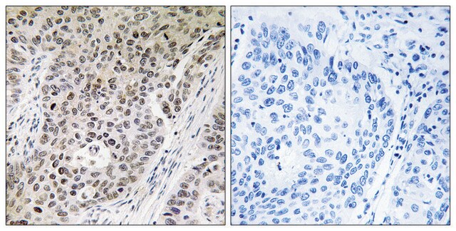 Anti-ZNF608 antibody produced in rabbit affinity isolated antibody