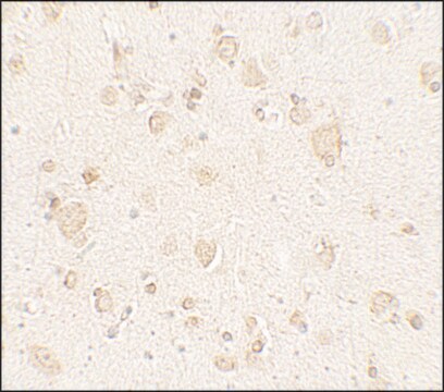 Anti-ULK4 antibody produced in rabbit affinity isolated antibody