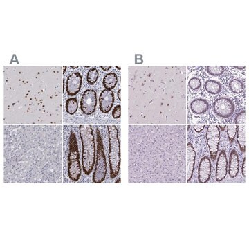 抗-SATB2 ウサギ宿主抗体 Prestige Antibodies&#174; Powered by Atlas Antibodies, affinity isolated antibody, buffered aqueous glycerol solution