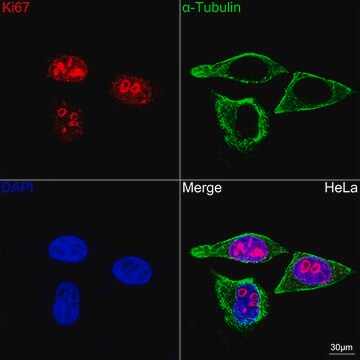 Anti-Ki67 Antibody, clone 5P6N6, Rabbit Monoclonal