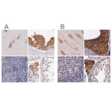 Anti-NSDHL antibody produced in rabbit Prestige Antibodies&#174; Powered by Atlas Antibodies, affinity isolated antibody, buffered aqueous glycerol solution