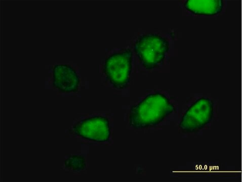 抗MLF2抗体 マウス宿主抗体 purified immunoglobulin, buffered aqueous solution