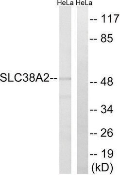 Anti-SLC38A2 antibody produced in rabbit affinity isolated antibody