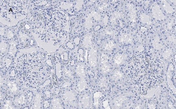 抗PLA2R1抗体 クローン1D5 ZooMAb&#174;ウサギモノクローナル recombinant, expressed in HEK 293 cells