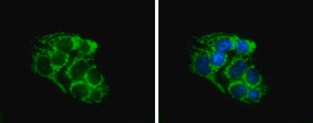 Anti-SLC25A1 antibody produced in rabbit affinity isolated antibody, buffered aqueous solution