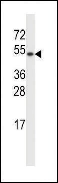 ANTI-TXNDC15(C-TERMINAL) antibody produced in rabbit affinity isolated antibody, buffered aqueous solution