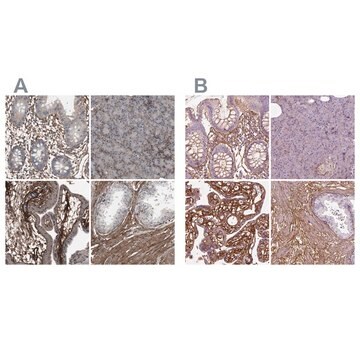 Anti-COL6A2 antibody produced in rabbit affinity isolated antibody, buffered aqueous glycerol solution