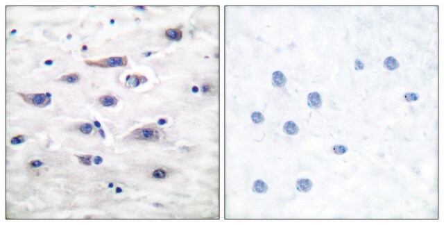 Anti-GLUR1 antibody produced in rabbit affinity isolated antibody