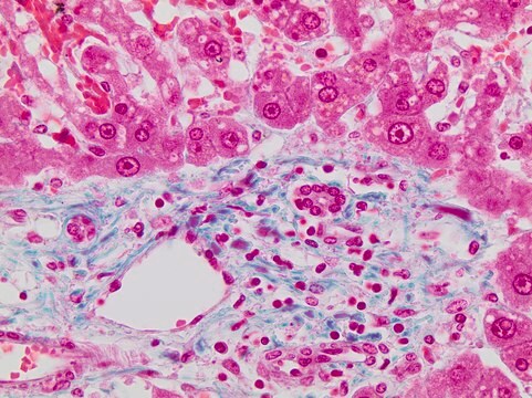 Disolución de Bouin histological fixative