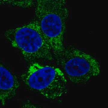 Anti-RTBDN antibody produced in rabbit Prestige Antibodies&#174; Powered by Atlas Antibodies, affinity isolated antibody, buffered aqueous glycerol solution