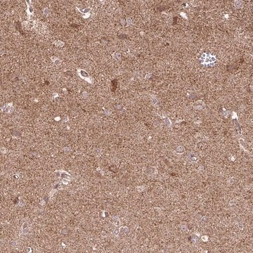 Anti-SPRED2 antibody produced in rabbit Prestige Antibodies&#174; Powered by Atlas Antibodies, affinity isolated antibody