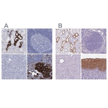 Anti-RHCG antibody produced in rabbit Prestige Antibodies&#174; Powered by Atlas Antibodies, affinity isolated antibody, buffered aqueous glycerol solution