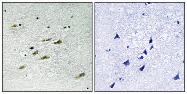 Anti-JAK2 antibody produced in rabbit affinity isolated antibody