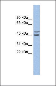 Anti-FBXL14, (N-terminal) antibody produced in rabbit affinity isolated antibody