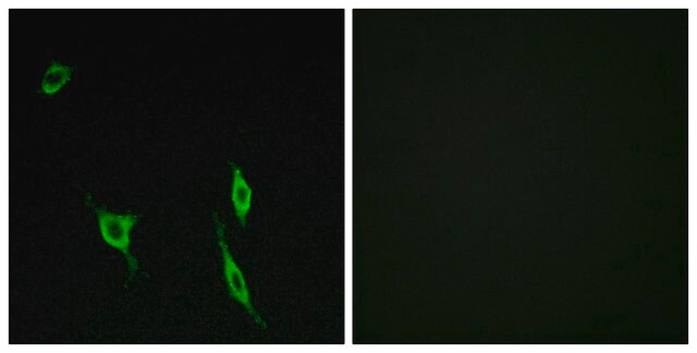 Anti-DCC antibody produced in rabbit affinity isolated antibody