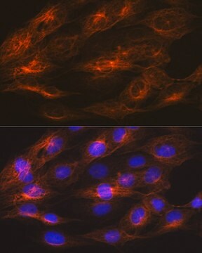 Anti-&#946;II-Tubulin/&#946;2-Tubulin Antibody, clone 1R3R9, Rabbit Monoclonal