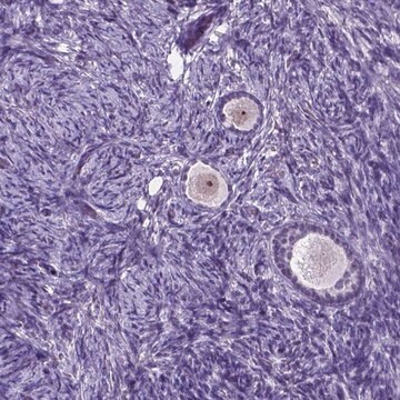 Anti-C18orf21 antibody produced in rabbit Prestige Antibodies&#174; Powered by Atlas Antibodies, affinity isolated antibody, buffered aqueous glycerol solution