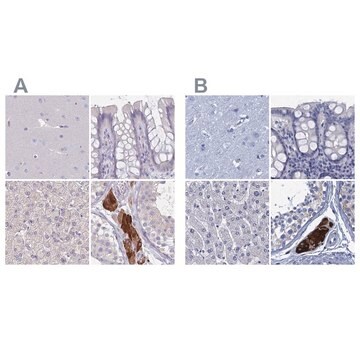 Anti-CYP51A1 antibody produced in rabbit Prestige Antibodies&#174; Powered by Atlas Antibodies, affinity isolated antibody, buffered aqueous glycerol solution