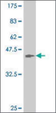 ANTI-ATOH1 antibody produced in mouse clone 2B7, purified immunoglobulin, buffered aqueous solution