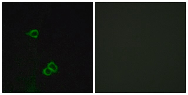 Anti-CXCR7 antibody produced in rabbit affinity isolated antibody