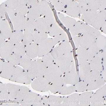 Anti-OGFOD1 antibody produced in rabbit Prestige Antibodies&#174; Powered by Atlas Antibodies, affinity isolated antibody, buffered aqueous glycerol solution