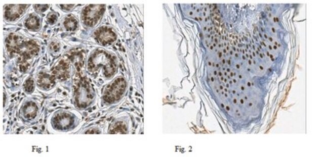 Anti-CHD-4 Antibody, clone 3F2/4 clone 3F2/4, from mouse