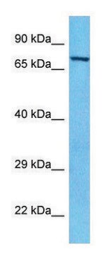 Anti-PAK6 (C-terminal) antibody produced in rabbit affinity isolated antibody