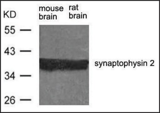 Anti-Synpr antibody produced in rabbit affinity isolated antibody