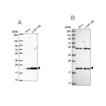 Anti-KIAA1143 antibody produced in rabbit Prestige Antibodies&#174; Powered by Atlas Antibodies, affinity isolated antibody