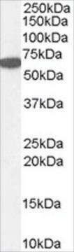 Anti-Catalase/CAT antibody produced in goat affinity isolated antibody, buffered aqueous solution