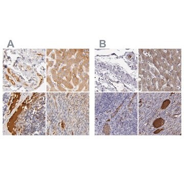 抗TF抗体 ウサギ宿主抗体 Ab1, Prestige Antibodies&#174; Powered by Atlas Antibodies, affinity isolated antibody, buffered aqueous glycerol solution