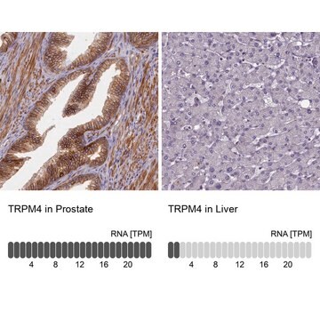 Anti-TRPM4 antibody produced in rabbit Prestige Antibodies&#174; Powered by Atlas Antibodies, affinity isolated antibody, buffered aqueous glycerol solution