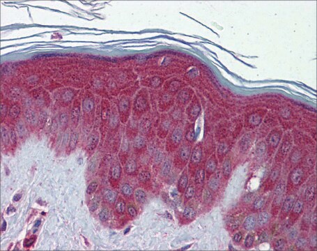 抗 PRDX6 (AB1) 兔抗 affinity isolated antibody