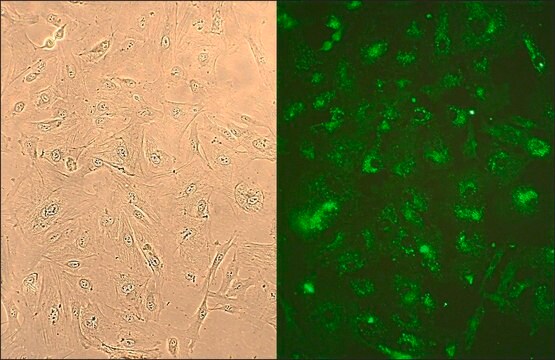 Ludzkie fibroblasty płucne: HLF, płodowe