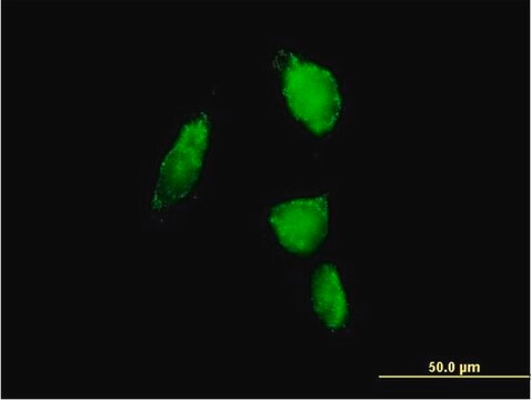 Anti-PSMA6 antibody produced in mouse purified immunoglobulin, buffered aqueous solution