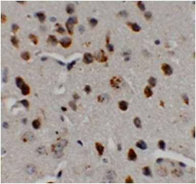 Anti-CHD7 Antibody from rabbit, purified by affinity chromatography