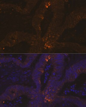 Anti-TFF1/pS2 Antibody, clone 6P6R7, Rabbit Monoclonal