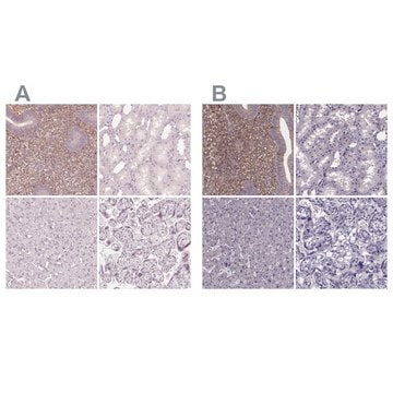 Anti-SFRP4 antibody produced in rabbit Prestige Antibodies&#174; Powered by Atlas Antibodies, affinity isolated antibody, buffered aqueous glycerol solution