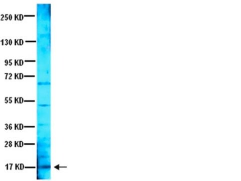 Anticuerpo anti-factor neurotrófico derivado del cerebro serum, Chemicon&#174;