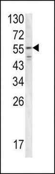 ANTI-FIBB(N-TERMINAL) antibody produced in rabbit purified immunoglobulin, buffered aqueous solution