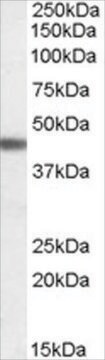 Anti-ADRB3 antibody produced in goat affinity isolated antibody, buffered aqueous solution