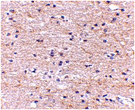 Anticuerpo anti-SATB2 from rabbit, purified by affinity chromatography