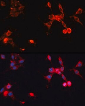 Anti-HSP70 antibody produced in rabbit