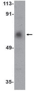 Anti-ACVR1C Antibody from rabbit, purified by affinity chromatography