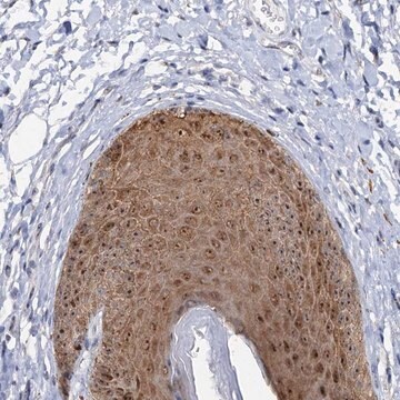 Anti-C2CD3 antibody produced in rabbit Prestige Antibodies&#174; Powered by Atlas Antibodies, affinity isolated antibody, buffered aqueous glycerol solution